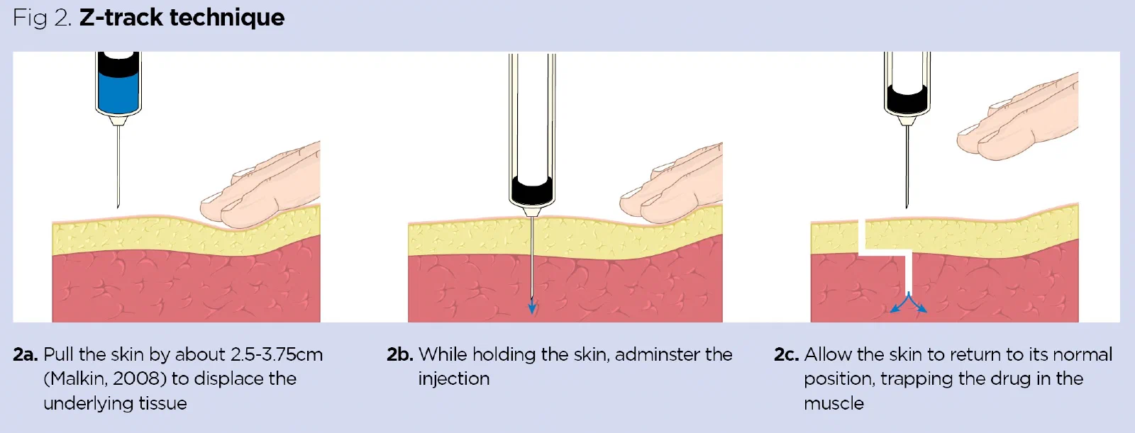 Three side-by-side explanatory panels